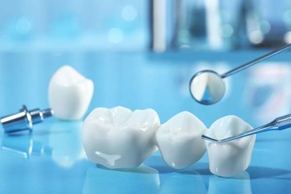 Understanding The Benefits Of Dental Bridge