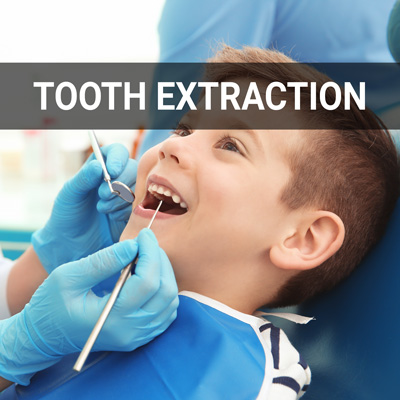 Navigation image for our Tooth Extraction page